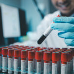 ¿Qué es un hemograma y qué información aporta?